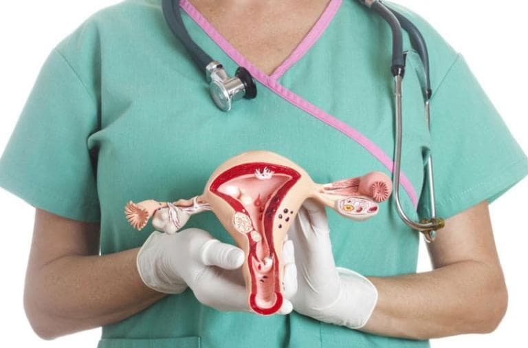 Phương Pháp Điều Trị PCOS - Chiến Lược Toàn Diện