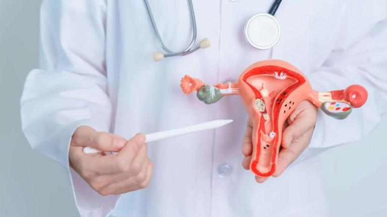 Buồng Trứng Đa Nang Là Gì