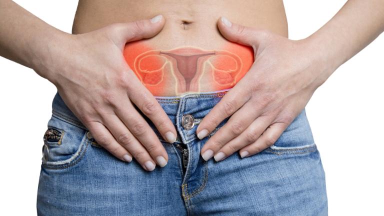 Triệu Chứng Nhận Biết PCOS