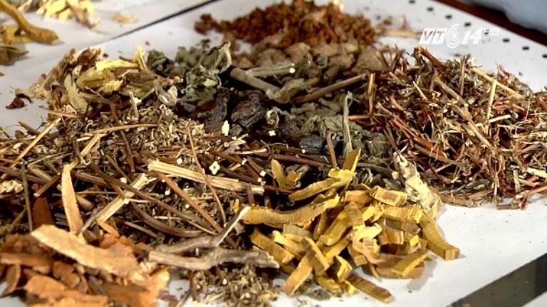 Quy trình điều trị và lưu ý thực tế