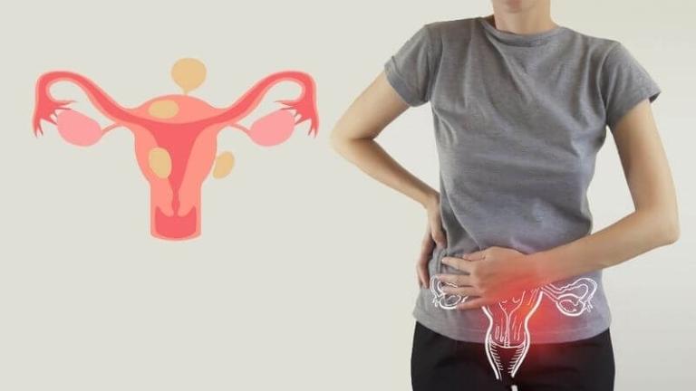 Cơ chế hoạt động của thuốc nam trong điều trị lạc nội mạc tử cung